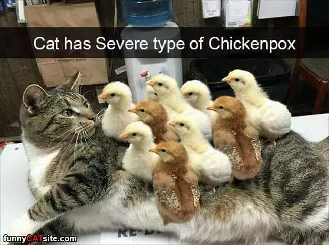 Chickenpox