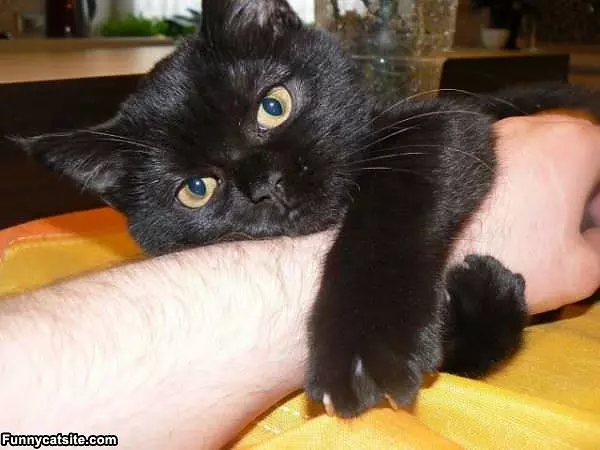 My Arm Now